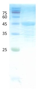 Deamidated gliadin peptide antigen Deamidated gliadin peptide antigen
