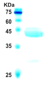 Hepatitis C virus (HCV) NS3 protein (AA1368-1490) Hepatitis C virus (HCV) NS3 protein (AA1368-1490)