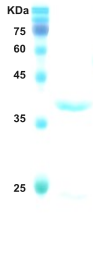 HIV-1 envelope gp120/gp41 protein HIV-1 envelope gp120/gp41 protein