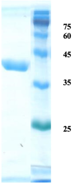 Helicobactor pylori (H. pylori) CagA protein (capture/detection) Helicobactor pylori (H. pylori) CagA protein (capture/detection)