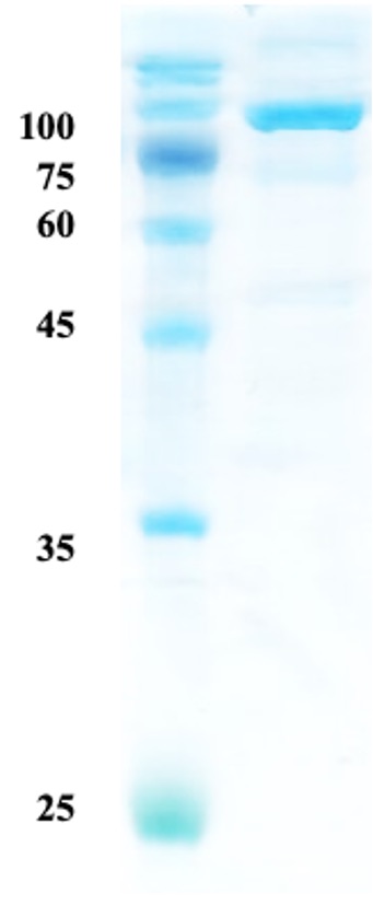 Helicobactor pylori (H. pylori) catalase (KatA) protein Helicobactor pylori (H. pylori) catalase (KatA) protein
