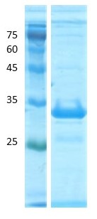 Deamidated gliadin peptide antigen Deamidated gliadin peptide antigen