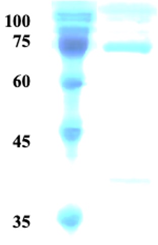 Treponema pallidum (Syphilis) p15/p17/p47 fusion protein Treponema pallidum (Syphilis) p15/p17/p47 fusion protein