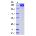 Human EGFR / HER1 / ErbB1 Protein (Fc Tag)