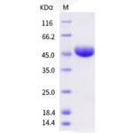 Human CD112 / Nectin-2 / PVRL2 Protein (ECD, His Tag)
