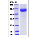 Human VEGFR2 / Flk-1 / CD309 / KDR Protein (Domain 2&3, Fc Tag)