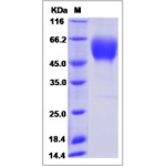 Human VEGFR2 / Flk-1 / CD309 / KDR Protein (Domain 1&2&3, His Tag)