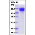 Human CD27 / TNFRSF7 Protein (Fc Tag)