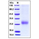 Human ALK-1 / ACVRL1 Protein (His Tag)