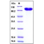 Human CD14 Protein (Fc Tag)