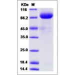 Human VEGFR1 / FLT-1 Protein (Fc Tag)