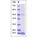 Human EG-VEGF / prokineticin-1 Protein (His Tag)