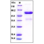 Human FGF9 Protein (Fc Tag)