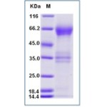 Human TIM-3 / HAVCR2 Protein (Fc Tag)