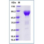 Human TIM-3 / HAVCR2 Protein (Fc Tag)
