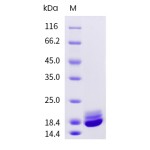 Human Cystatin C / CST3 Protein (His Tag)