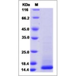 Human Cystatin C / CST3 Protein