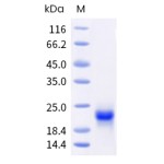Human VEGF-C Protein (His Tag)