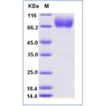 Human CD226 Protein (Fc Tag)