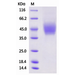 Human CD226 / DNAM-1 Protein (ECD, His Tag)