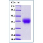 Mouse HVEM / TNFRSF14 Protein (His Tag)