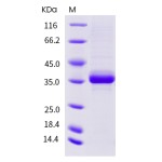 Human EGF / Epidermal Growth Factor Protein (Fc Tag)