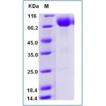 Human CD80 / B7-1 Protein (ECD, Fc Tag)