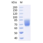 Human CD86 / B7-2 Protein (Fc Tag)