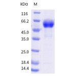 Human Complement Factor H / CFH Protein (His Tag)