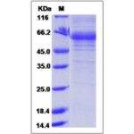 Human Adiponectin / Acrp30 / ADIPOQ Protein (Fc Tag)
