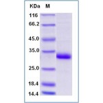 Human Adiponectin / Acrp30 Protein (His Tag)