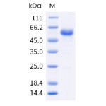 Human CD40 / TNFRSF5 Protein (ECD, Fc Tag)