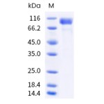 Human CD30 / TNFRSF8 Protein (Fc Tag)