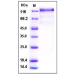 Human VEGFR3 / FLT4 Protein (His Tag)