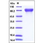 Human CD113 / Nectin-3 / PVRL3 Protein (His Tag)