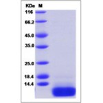Human CCL5 / RANTES Protein