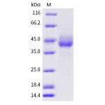 Human TIGIT / VSTM3 Protein (Fc Tag)