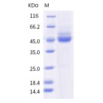 Human TIGIT Protein (ECD, mFc Tag)