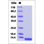 Human CCL8 / MCP-2 Protein (His Tag)