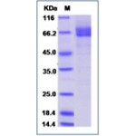 Human Galectin-9 / LGALS9 Protein (Fc Tag)