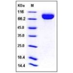 Human CD111 / Nectin-1 / PVRL1 Protein (Fc Tag)