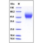 Human CD111 / Nectin-1 / PVRL1 Protein (His Tag)