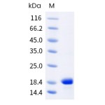 Human alpha-Synuclein Protein (H50Q)
