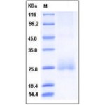Human CD160 Protein (His Tag)