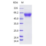 Human CD47 Protein (ECD,Fc Tag)