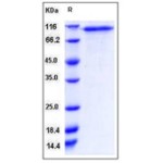Human CD93 / C1QR1 Protein (His Tag)