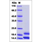 Human CCL2 / MCP-1 / MCP1 Protein (His Tag)