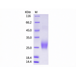 Mouse CTLA4 / CD152 Protein (ECD,His Tag)