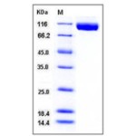 Mouse VEGFR3 / FLT-4  Protein (His Tag)