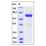Mouse IFNB1 / IFN-beta / Interferon beta Protein (Fc Tag)